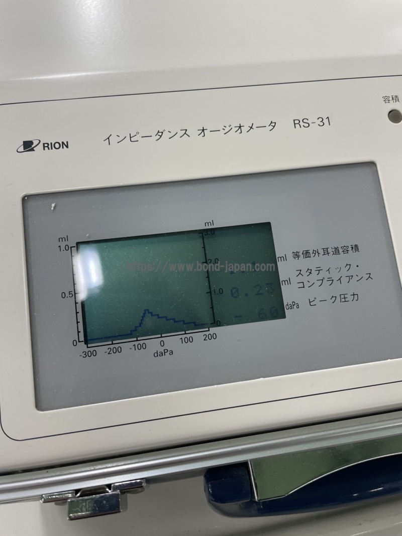 rs-31 インピーダンスオージオメーター リオン RION-