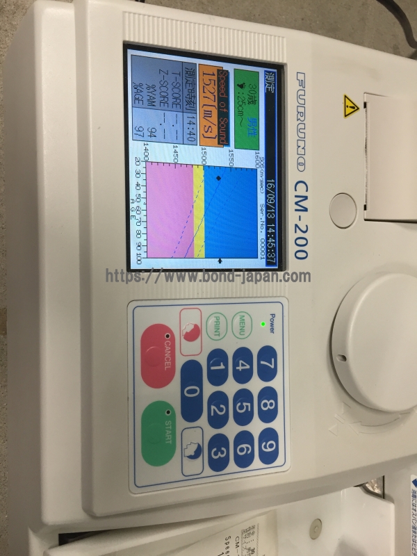 超音波骨密度測定装置｜古野電気株式会社 システム機器事業部｜CM-200｜中古医療機器の販売・買取 なら株式会社 ボンドジャパン