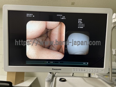 LED Medical Grade monitor | Panasonic | EJ-MLA26N