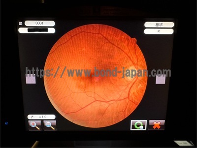 Fundus Camera | NIDEK | AFC-330