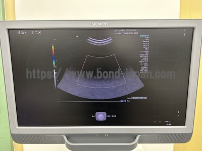 Ultrasound | SIEMENS | Acuson S1000 HELX