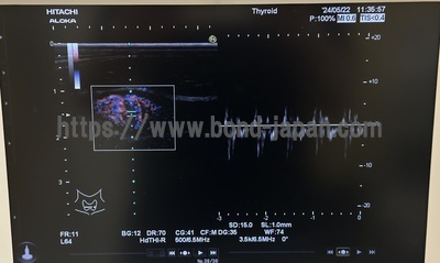 Ultrasound | HITACHI | Noblus