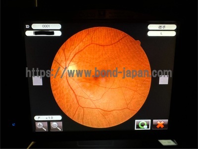 Fundus Camera | NIDEK | AFC-330