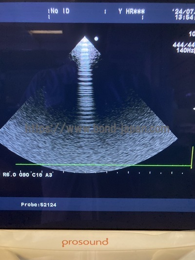 4D Ultrasound | HITACHI | Alpha 7