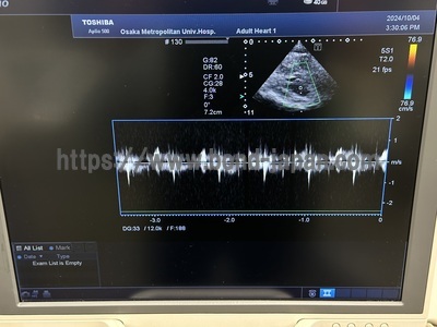 4D Ultrasound | CANON | Aplio 500