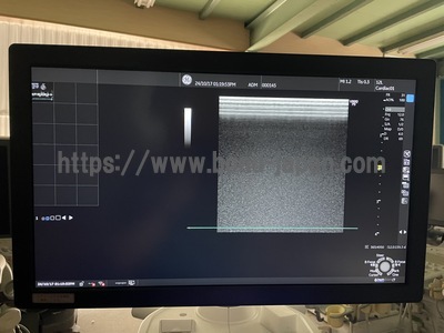 超音波診断装置 | GEヘルスケア・ジャパン株式会社 | LOGIQ P9の写真