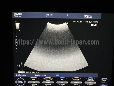 Color Doppler | HITACHI | F37