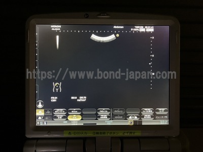 Ultrasound | HITACHI | Noblus