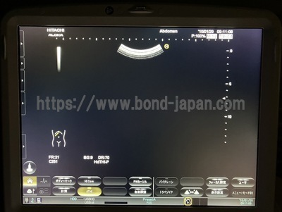 Ultrasound | HITACHI | Noblus