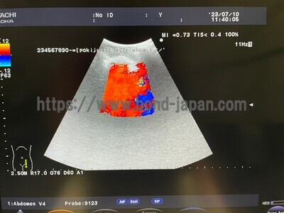 Color Doppler | HITACHI | F37