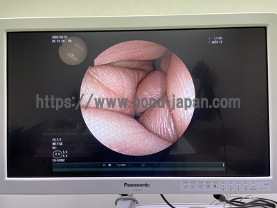 Endoscopy System | FUJIFILM | EPX-4450HD