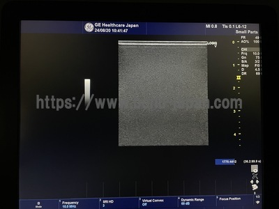 超音波診断装置/カラードプラ | GEヘルスケア・ジャパン株式会社 | LOGIQ V5 Expertの写真
