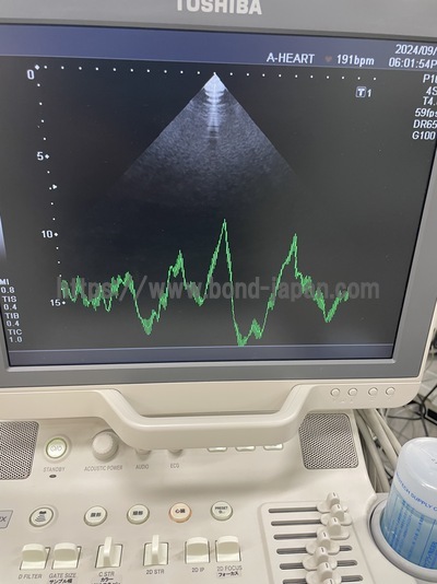 Color Doppler | CANON | SSA-590A Nemio MX