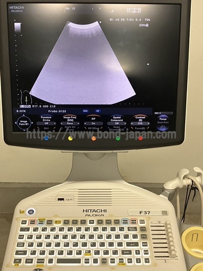 Color Doppler | HITACHI | F37