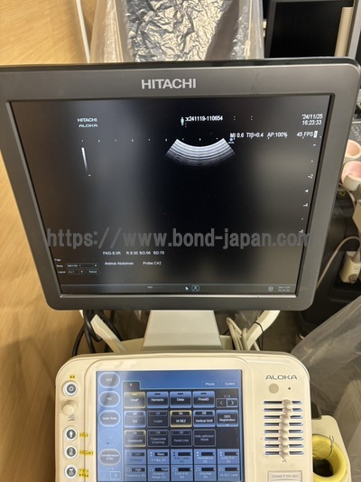 Ultrasound System | HITACHI | ARIETTA 60