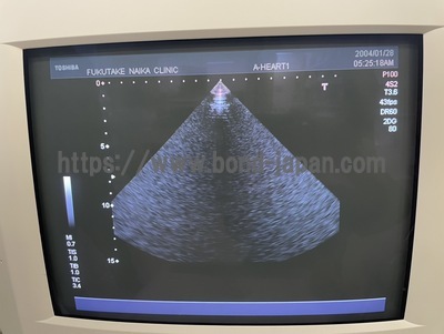 Color Doppler | CANON | SSA-550A Nemio20