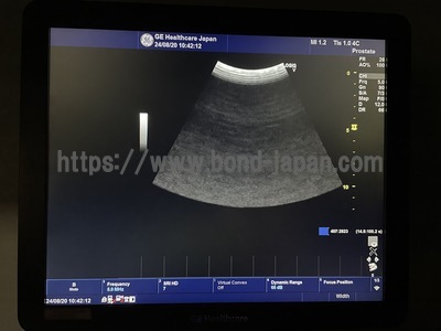 Color Doppler | GE | LOGIQ V5 Expert