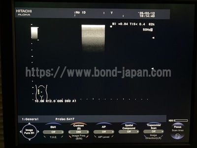 Color Doppler | HITACHI | F37